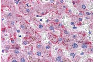 Human Liver: Formalin-Fixed, Paraffin-Embedded (FFPE) (SORBS1 anticorps  (AA 300-313))