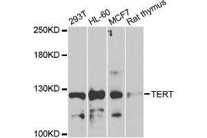 Western blot analysis of extracts of various cell lines, using TERT antibody (ABIN1875058) at 1:1000 dilution. (TERT anticorps)