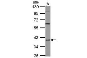 Image no. 1 for anti-Heterogeneous Nuclear Ribonucleoprotein D (HNRNPD) (AA 18-225) antibody (ABIN1498704) (HNRNPD/AUF1 anticorps  (AA 18-225))