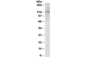 Western blot testing of mouse fetal brain lysate with SIRT1 antibody at 1ug/ml. (SIRT1 anticorps)