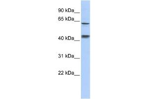 WB Suggested Anti-KLHL8 Antibody Titration:  0. (KLHL8 anticorps  (Middle Region))