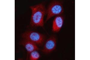 IF analysis of MTAP using anti-MTAP antibody (ABIN7601258).