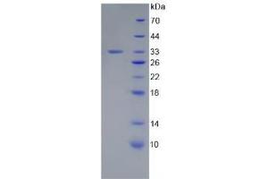 SDS-PAGE analysis of Human Laminin gamma 1 Protein. (Laminin gamma 1 Protéine)