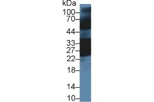 Detection of CRYbB1 in Mouse Eye lysate using Polyclonal Antibody to Crystallin Beta B1 (CRYbB1) (CRYBB1 anticorps  (AA 6-186))