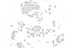 Immunocytochemistry (ICC) image for anti-BRCA1 Associated Protein-1 (Ubiquitin Carboxy-terminal Hydrolase) (BAP1) (AA 475-525) antibody (ABIN7795816)