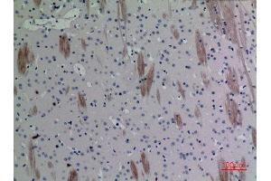 Immunohistochemistry (IHC) analysis of paraffin-embedded Mouse Brain, antibody was diluted at 1:100. (CCL26 anticorps  (Internal Region))