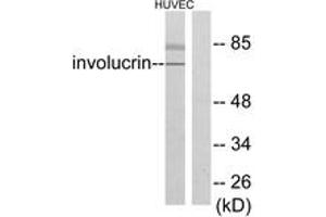 Western blot analysis of extracts from HuvEc cells, using Involucrin Antibody. (Involucrin anticorps  (AA 536-585))