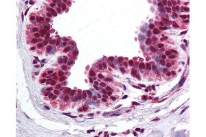 Anti-BRD2 antibody IHC of human breast. (BRD2 anticorps  (AA 524-573))