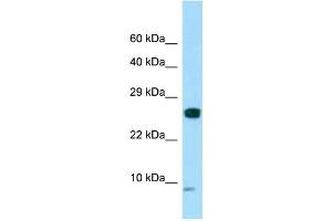 WB Suggested Anti-SPANXC Antibody Titration: 1. (SPANXC anticorps  (N-Term))