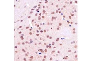 IHC testing of FFPE rat brain tissue with TBP antibody at 1:25 dilution. (TBP anticorps)