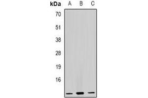 Western blot analysis of GHRH expression in Raji (A), HL60 (B), mouse liver (C) whole cell lysates. (GHRH anticorps)