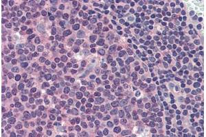 Human Tonsil (formalin-fixed, paraffin-embedded) stained with MCL1 antibody ABIN337283 at 10 ug/ml followed by biotinylated anti-mouse IgG secondary antibody ABIN481714, alkaline phosphatase-streptavidin and chromogen. (MCL-1 anticorps)