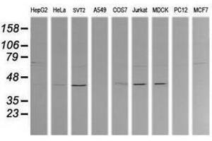 Image no. 1 for anti-Mitogen-Activated Protein Kinase Kinase 1 (MAP2K1) antibody (ABIN1499390) (MEK1 anticorps)