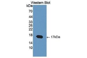 Western Blotting (WB) image for anti-Cartilage Oligomeric Matrix Protein (COMP) (AA 123-240) antibody (ABIN1867326) (COMP anticorps  (AA 123-240))