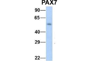 Host:  Rabbit  Target Name:  NOP56  Sample Type:  Human Fetal Muscle  Antibody Dilution:  1. (PAX7 anticorps  (Middle Region))