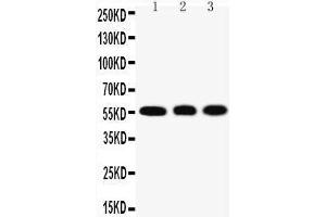Anti-KLF4 antibody, Western blotting Lane 1: HELA Cell Lysate Lane 2: A549 Cell Lysate Lane 3: U20S Cell Lysate (KLF4 anticorps  (N-Term))