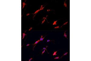 Immunofluorescence analysis of PC12 cells using ENO2 antibody. (ENO2/NSE anticorps  (AA 195-434))