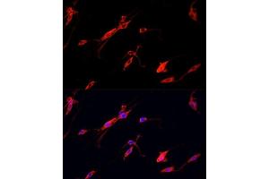 Immunofluorescence analysis of PC12 cells using ENO2 antibody.