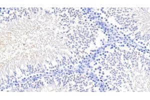 Detection of Kim1 in Rat Testis Tissue using Monoclonal Antibody to Kidney Injury Molecule 1 (Kim1) (HAVCR1 anticorps  (AA 22-235))
