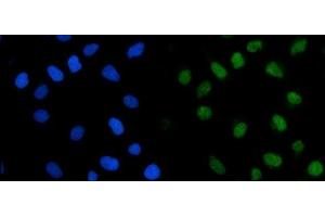 IF analysis of TRMT1 using anti-TRMT1 antibody (ABIN7602171). (TRMT1 anticorps  (AA 61-626))