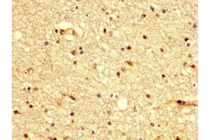 IHC image of ABIN7145183 diluted at 1:300 and staining in paraffin-embedded human brain tissue performed on a Leica BondTM system. (BDKRB2 anticorps  (AA 336-391))