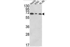 Western blot analysis of PIGR Antibody (C-term) in HepG2,K562,HL-60 cell line lysates (35ug/lane).