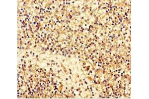Immunohistochemistry of paraffin-embedded human spleen tissue using ABIN7159348 at dilution of 1:100 (Majin (AA 1-216) anticorps)
