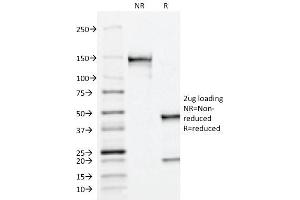 SDS-PAGE Analysis Purified PSAP Mouse Monoclonal Antibody (ACPP/1338). (ACPP anticorps)