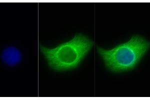 Detection of TUBb in Human Hela cell using Anti-Tubulin Beta (TUBb) Monoclonal Antibody