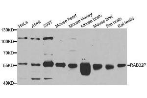 Western blot analysis of extracts of various cell lines, using RAB3IP antibody.