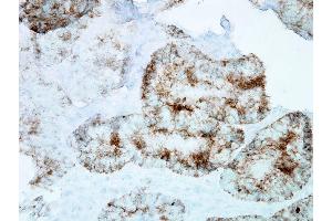 Immunohistochemistry analysis using Mouse Anti-Hsp60 Monoclonal Antibody, Clone LK-1 .