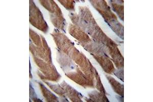 Immunohistochemistry analysis in formalin fixed and paraffin embedded human skeletal muscle reacted with Matrilin-1 Antibody (C-term) followed which was peroxidase conjugated to the secondary antibody and followed by DAB staining. (MATN1 anticorps  (C-Term))