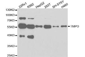 Western blot analysis of extracts of various cell lines, using TMPO antibody. (Thymopoietin anticorps)