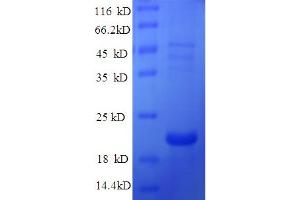 SDS-PAGE (SDS) image for Defensin, beta 114 (DEFB114) (AA 23-67) protein (His-SUMO Tag) (ABIN5711443)