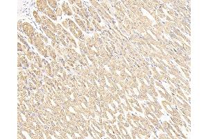 Immunohistochemistry analysis of paraffin-embedded mouse stomach cancer using CK-7 Monoclonal Antibody at dilution of 1:300. (Cytokeratin 7 anticorps)
