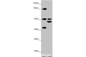Western blot All lanes: NYX antibody at 7. (Nyctalopin anticorps  (AA 282-481))