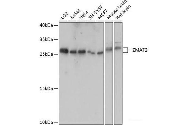 ZMAT2 anticorps