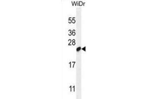 Western Blotting (WB) image for anti-Chromosome 19 Open Reading Frame 84 (C19orf84) antibody (ABIN2995151) (C19orf84 anticorps)