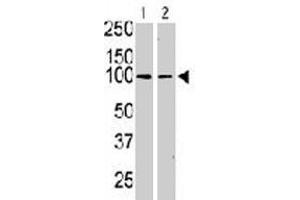 The KIT polyclonal antibody  is used in Western blot to detect KIT in serum-starved HeLa cell lysate (lane 1) and primate testis tissue lysate (lane 2) . (KIT anticorps  (N-Term))
