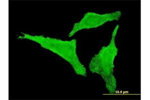 Immunofluorescence of monoclonal antibody to CDKL2 on HeLa cell. (CDKL2 anticorps  (AA 394-493))