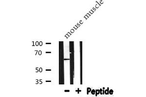Western blot analysis of CALR expression in Mouse muscle lysate (Calreticulin anticorps  (N-Term))