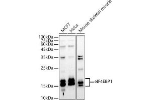 Western blot analysis of extracts of various cell lines, using eIF4EBP1 antibody (ABIN3021843, ABIN3021844, ABIN3021845 and ABIN1512858) at 1:1000 dilution. (eIF4EBP1 anticorps  (C-Term))