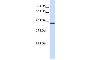 WB Suggested Anti-RASSF7 Antibody Titration: 0. (RASSF7 anticorps  (Middle Region))