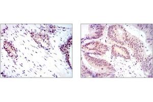 Immunohistochemistry (IHC) image for anti-Yes-Associated Protein 1 (YAP1) antibody (ABIN1109527)