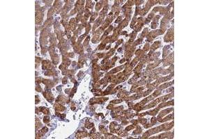 Immunohistochemical staining of human liver with KNCN polyclonal antibody  shows strong cytoplasmic positivity in hepatocytes at 1:50-1:200 dilution. (Kinocilin anticorps)