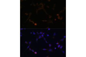 Immunofluorescence analysis of NIH/3T3 cells using UBE2L6 antibody (ABIN6134446, ABIN6149808, ABIN6149809 and ABIN6217753) at dilution of 1:100. (UBE2L6 anticorps  (C-Term))