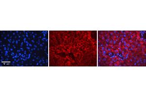 Rabbit Anti-ERCC8 Antibody    Formalin Fixed Paraffin Embedded Tissue: Human Adult liver  Observed Staining: Cytoplasmic,Nuclear Primary Antibody Concentration: 1:600 Secondary Antibody: Donkey anti-Rabbit-Cy2/3 Secondary Antibody Concentration: 1:200 Magnification: 20X Exposure Time: 0.