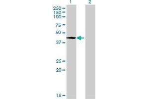 Western Blot analysis of STYK1 expression in transfected 293T cell line by STYK1 monoclonal antibody (M02), clone 3D2.