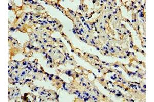 Immunohistochemistry of paraffin-embedded human lung tissue using  at dilution of 1:100 (CCL11 anticorps  (AA 1-97))