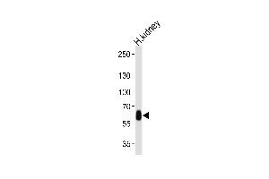 Western blot analysis of lysate from human kidney tissue lysate, using DFNB31 Antibody (Center) (ABIN655065 and ABIN2844695).
